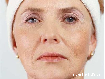 超声骨密度分析仪厂家谈皱纹与骨密度降低的关系