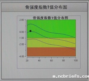 骨密度检测仪测量结果了解一下啦! 骨密度检测仪测量结果了解一下啦!