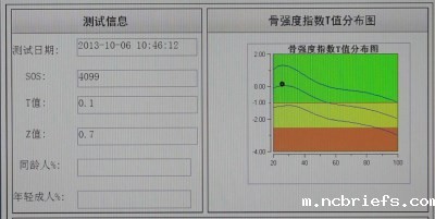 骨密度检测仪测量结果了解一下啦! 骨密度检测仪测量结果了解一下啦!