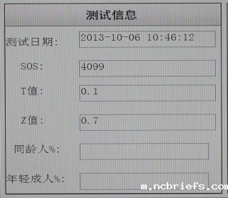 骨密度检测仪测量结果了解一下啦! 骨密度检测仪测量结果了解一下啦!