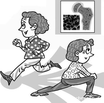 便携式骨密度仪检测原发性骨质疏松症诊治方法 便携式骨密度仪检测原发性骨质疏松症诊治方法