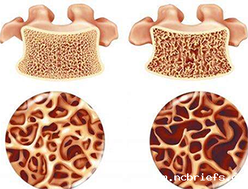 便携式骨密度检测仪如何在竞争中生存