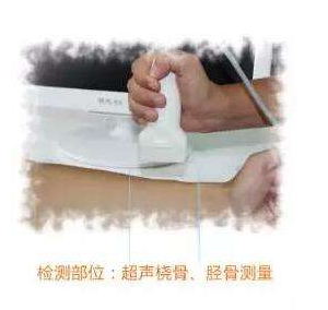 全身哪些部位可以采用必威app精装版下载官网安装苹果测量骨密度？