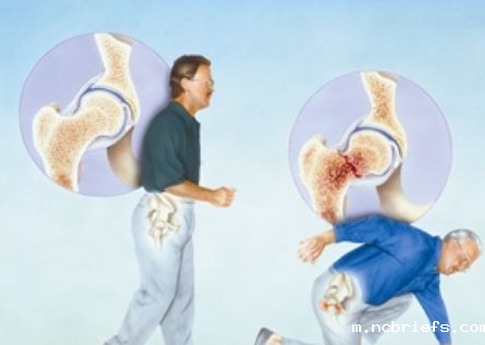 必威app精装版下载官网安装苹果厂家剖析宝宝骨密度低反映的问题 必威app精装版下载官网安装苹果厂家剖析宝宝骨密度低反映的问题