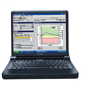 骨密度检测仪 骨密度检测仪