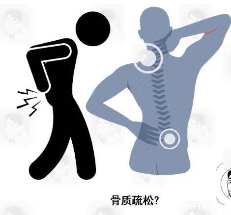 必威app精装版下载官网安装苹果生产厂家提示有可能身患骨质疏松的几个身体信号 必威app精装版下载官网安装苹果生产厂家提示有可能身患骨质疏松的几个身体信号