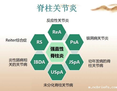 超声骨密度测定仪厂家提醒越歇息腰越痛当心得了“脊柱关节炎” 超声骨密度测定仪厂家提醒越歇息腰越痛当心得了“脊柱关节炎”