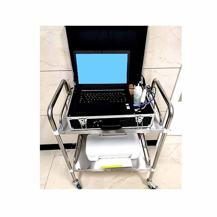 便携式骨密度仪 便携式骨密度仪