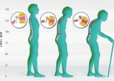 GK-7000型号骨密度检测仪生产厂家国康小编建议怎样添加骨量?