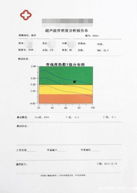 GK-7000类型超声波骨密度测试仪器品牌国康教您看儿童骨密度查看报告!